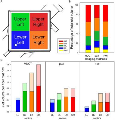 Computer based visualization of clot structures in extracorporeal membrane oxygenation and histological clot investigations for understanding thrombosis in membrane lungs